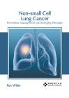 Non-Small Cell Lung Cancer: Prevention, Management and Emerging Therapies By Rex White (Editor) Cover Image