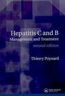 Hepatitis B and C: Management and Treatment Cover Image