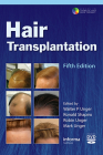 Hair Transplantation Cover Image