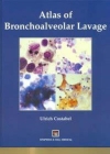 Atlas of Bronchoalveolar Lavage Cover Image
