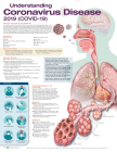 Understanding Coronavirus Disease 2019 (COVID-19) Anatomical Chart By Anatomical Chart Company		 (Prepared for publication by) Cover Image