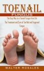 Toenail Fungus: The Easy Way to a Toenail Fungus-free Life (The Treatment and Cure of Toe Nail and Fingernail Fungus) By Walter Rosales Cover Image