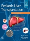 Pediatric Liver Transplantation: A Clinical Guide Cover Image
