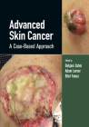 Advanced Skin Cancer: A Case-Based Approach By Debjani Sahni (Editor), Adam Lerner (Editor), Bilal Fawaz (Editor) Cover Image