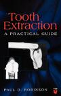 Tooth Extraction: A Practical Guide By Paul D. Robinson Cover Image