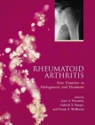 Rheumatoid Arthritis: Frontiers in Pathogenesis and Treatment Cover Image