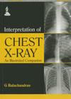 Interpretation of Chest X-Ray: An Illustrated Companion Cover Image