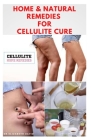 Home & Natural Remedies for Cellulite Cure: Practical Guide On The Best Remedies To Get Rid Of Your Cellulite: Everything You Need To Know By Dr Elizabeth David Cover Image