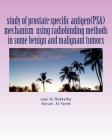 study of prostate specific antigen(PSA) mechanism using radiobinding methods in some benign and malignant tumors: PSA in tumors By Hassan H. Al-Saeed, Sami a. Al-Mudhaffar Dr Cover Image