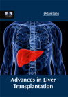 Advances in Liver Transplantation Cover Image