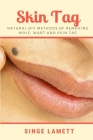 Skin Tag: Natural DIY Methods of removing Mole, Wart and Skin Tag Cover Image
