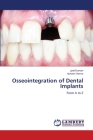 Osseointegration of Dental Implants Cover Image