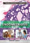 Endometriosis (Your Sexual Health) By Jennifer Landau Cover Image