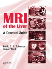 MRI of the Liver: A Practical Guide Cover Image