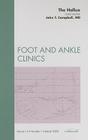 The Hallux, an Issue of Foot and Ankle Clinics: Volume 14-1 (Clinics: Orthopedics #14) Cover Image