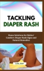Diaper Rash: Home Solutions for Babies' Comfort: Diaper Rash Signs and Natural Remedies By Carl Juan Cover Image