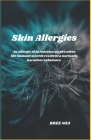 Skin Allergies: An allergic skin reaction occurs when the immune system reacts to a normally harmless substance. Cover Image