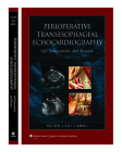Perioperative Transesophageal Echocardiography Self-Assessment and Review Cover Image