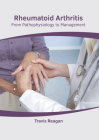 Rheumatoid Arthritis: From Pathophysiology to Management Cover Image
