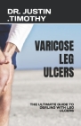Varicose Leg Ulcers: The Ultimate Guide to Dealing with Leg Ulcers By Justin Timothy Cover Image