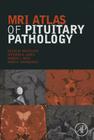 MRI Atlas of Pituitary Pathology By Kevin M. Pantalone, Stephen E. Jones, Robert J. Weil Cover Image
