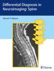 Differential Diagnosis in Neuroimaging: Spine Cover Image