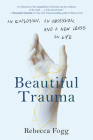 Beautiful Trauma: An Explosion, an Obsession, and a New Lease on Life By Rebecca Fogg Cover Image