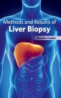 Methods and Results of Liver Biopsy By Amelia Foster (Editor) Cover Image