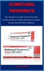 Clobetasol Propionate: The Ultimate User Guide Used To Treat Skin Conditions Such As Psoriasis, Seborrheic Dermatitis, Eczema And Other Skin By Arneson John Cover Image