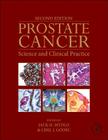 Prostate Cancer: Science and Clinical Practice Cover Image