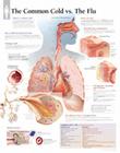 The Common Cold Vs Flu Chart: Wall Chart Cover Image