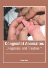Congenital Anomalies: Diagnosis and Treatment By Elsa Hunt (Editor) Cover Image