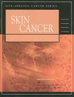 Skin Cancer (Site-Specific Cancer) Cover Image