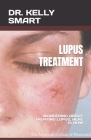 Lupus Treatment: Wondering about Treating Lupus, Here Is How Cover Image