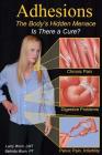 Adhesions: The Body's Inner Menace - Is There a Cure? Cover Image