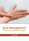 Scar Management: Practical Dermatology By Asher Hill (Editor) Cover Image
