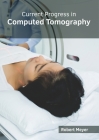 Current Progress in Computed Tomography Cover Image