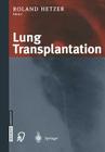 Lung Transplantation Cover Image