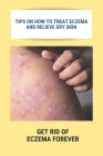 Tips On How To Treat Eczema And Relieve Dry Skin: Get Rid Of Eczema Forever: Overcome Eczema By Courtney Apkin Cover Image