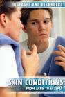 Skin Conditions: From Acne to Eczema (Diseases & Disorders) By Donna Reynolds Cover Image