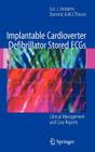 Implantable Cardioverter Defibrillator Stored ECGs: Clinical Management and Case Reports Cover Image