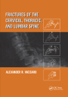 Fractures of the Cervical, Thoracic, and Lumbar Spine By Alexander R. Vaccaro Cover Image