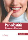Periodontitis: Diagnosis and Treatment By Joel Turner (Editor) Cover Image