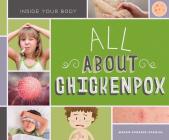 All about Chickenpox (Inside Your Body) By Megan Borgert-Spaniol Cover Image