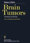 Brain Tumors: Their Biology and Pathology By K. J. Zülch, P. Bailey (Preface by), A. B. Rothballer (Translator) Cover Image