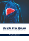 Chronic Liver Disease: Clinical Assessment and Treatment By Angelina Glanton (Editor) Cover Image