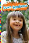 Down Syndrome (Living with) Cover Image