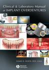 Clinical and Laboratory Manual of Implant Overdentures Cover Image