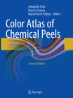 Color Atlas of Chemical Peels Cover Image
