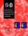 Magnetic Resonance Imaging in Stroke Cover Image